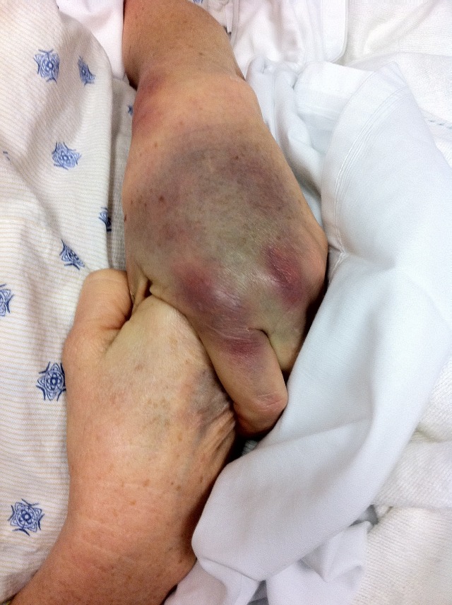 2011-05-16-Janeen's TBI-13.jpg